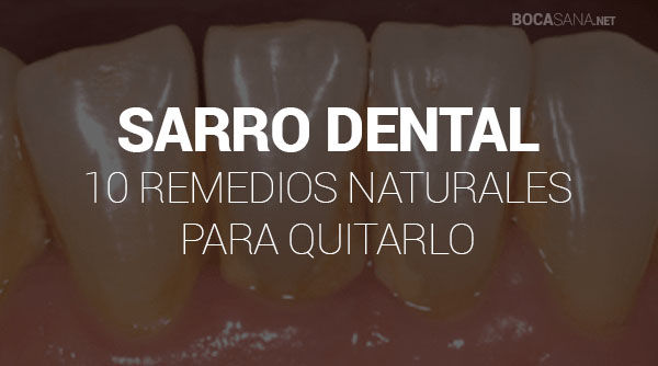 Eliminar Sarro de los Dientes