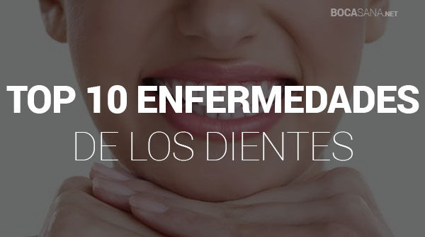 Enfermedades de los Dientes