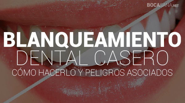 Blanqueamiento Dental Casero 【 Cómo Hacerlo y Peligros Asociados 】