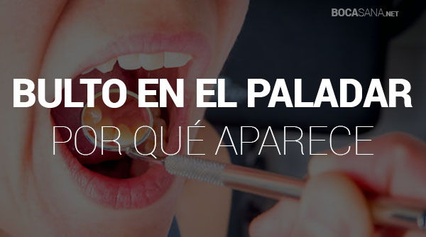 Bultos en el Paladar 【 Por Qué Sale y Cómo Quitarlo 】