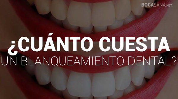 ¿Cuánto Cuesta un Blanqueamiento Dental? 【 Lugares Recomendados 】