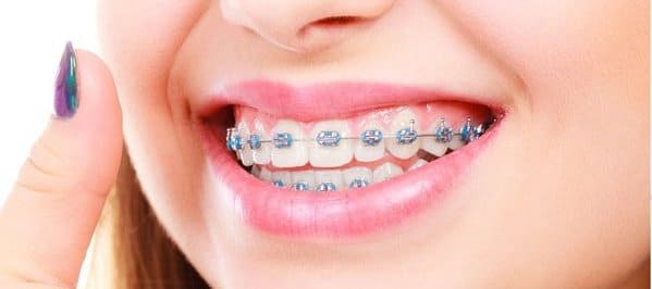 ortodoncia dolor de encias