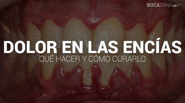 Dolor De Encías 【Causas Comunes y Tratamientos】