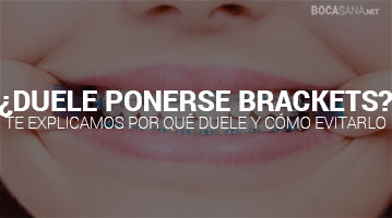 ᐈ ¿Duele Ponerse los Brackets? 【Conoce nuestra Experiencia】