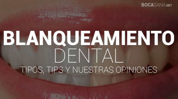 ¿En Qué Consiste un Blanqueamiento Dental? 【2025】