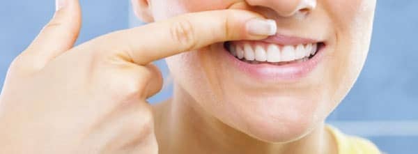 sintomas de las encias retraidas