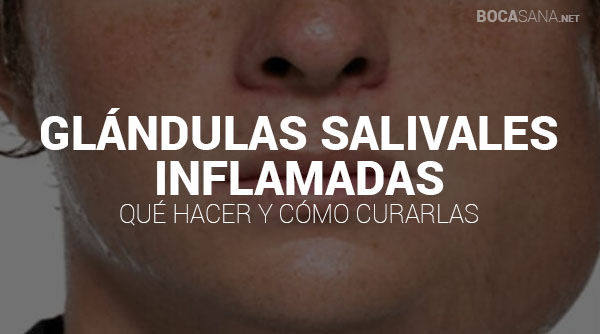 ¿Glándulas Salivales Inflamadas? 【Causas y Tratamientos】
