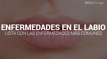 Enfermedades en los Labios