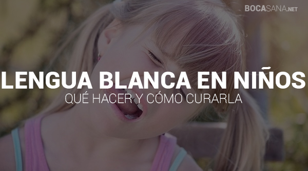 【 Lengua Blanca en Niños 】 ¿Qué Debes Hacer? ⊛