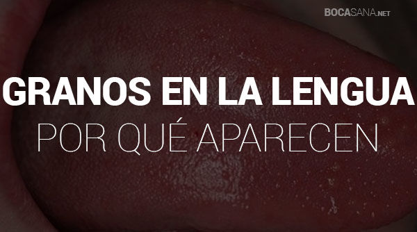 Granos en la Lengua