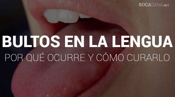 Bultos en la Lengua