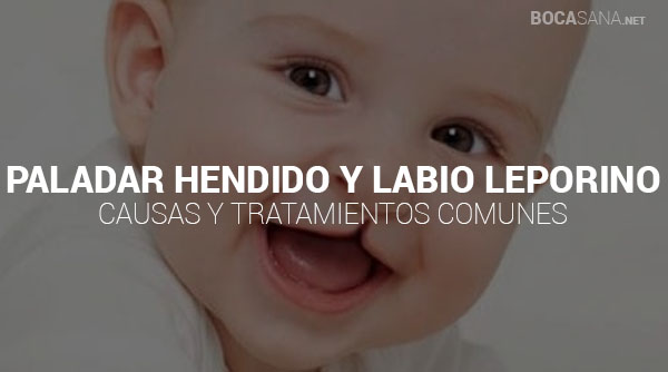 Paladar Hendido y Labio Leporino