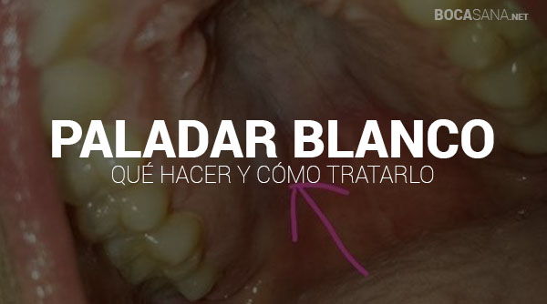 Paladar Blanco