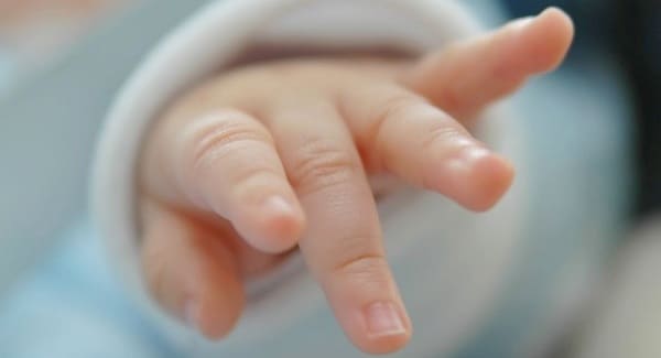 tratamiento labio leporino