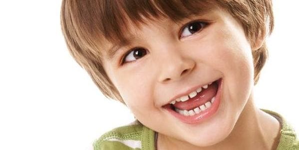 paladar ojival paladar estrecho