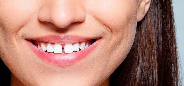 que es el disyuntor palatino