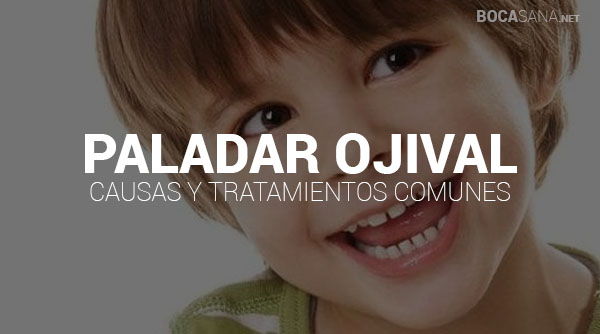 Paladar Ojival 【Causas, Consecuencias y Tratamientos 2025 】