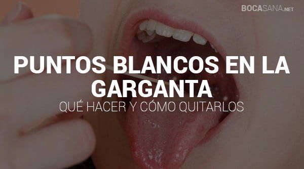 Puntos Blancos en la Garganta 【Causas y Tratamientos】