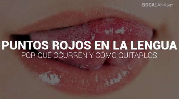 Puntos Rojos en la Lengua