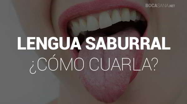 ¿Qué es la Lengua Saburral? 【 Y Cómo Curarla 】