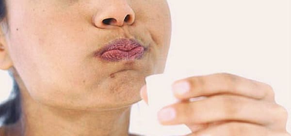 remedios caseros hongos en la lengua