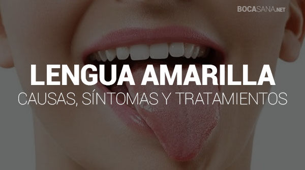 ¿Tienes la Lengua Amarilla? 【 Qué lo Causa y Cómo Curarla 】