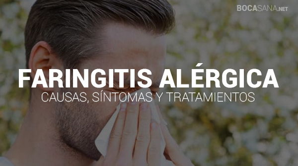 Faringitis Alérgica