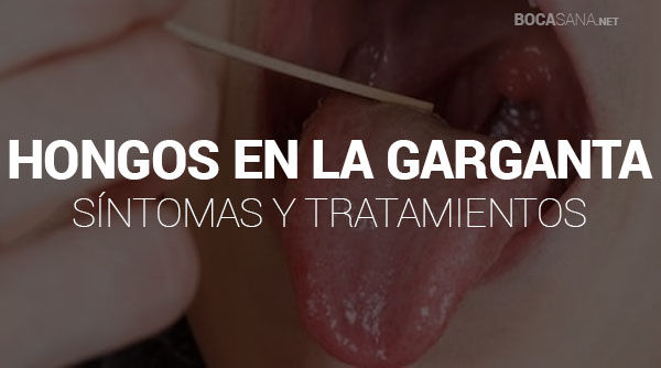 Hongos en la Garganta