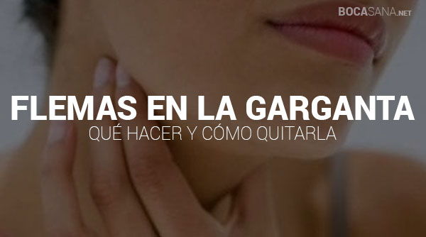 Flemas en la Garganta