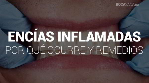 Encías Inflamadas