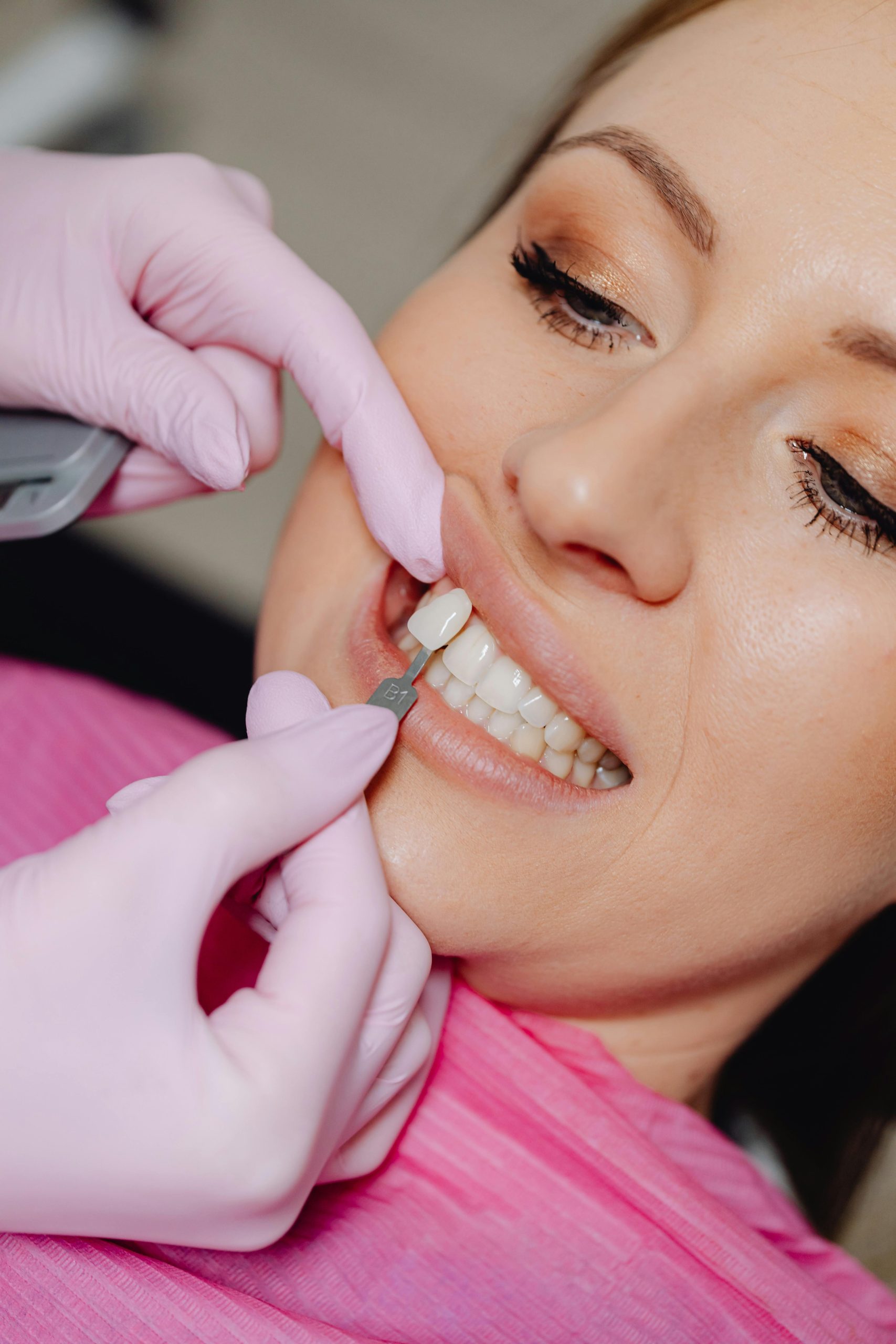 ¿Puedo ponerme carillas si llevo retenedores? - Salud dental